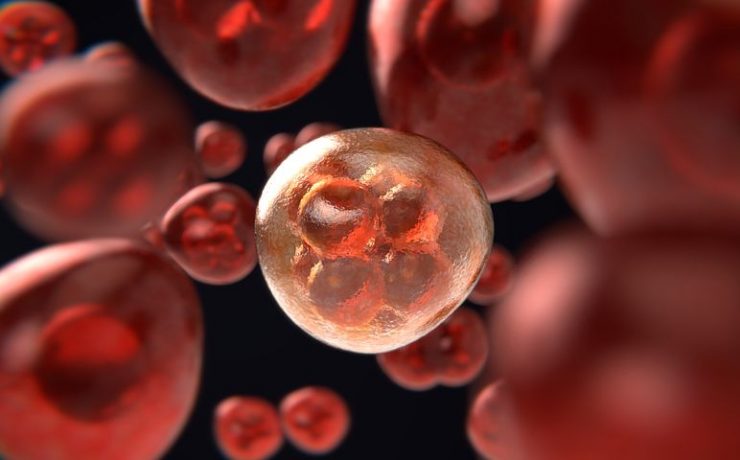 Medicina Integrativă - Abordarea Completă a Sănătății Tale Adenocarcinom