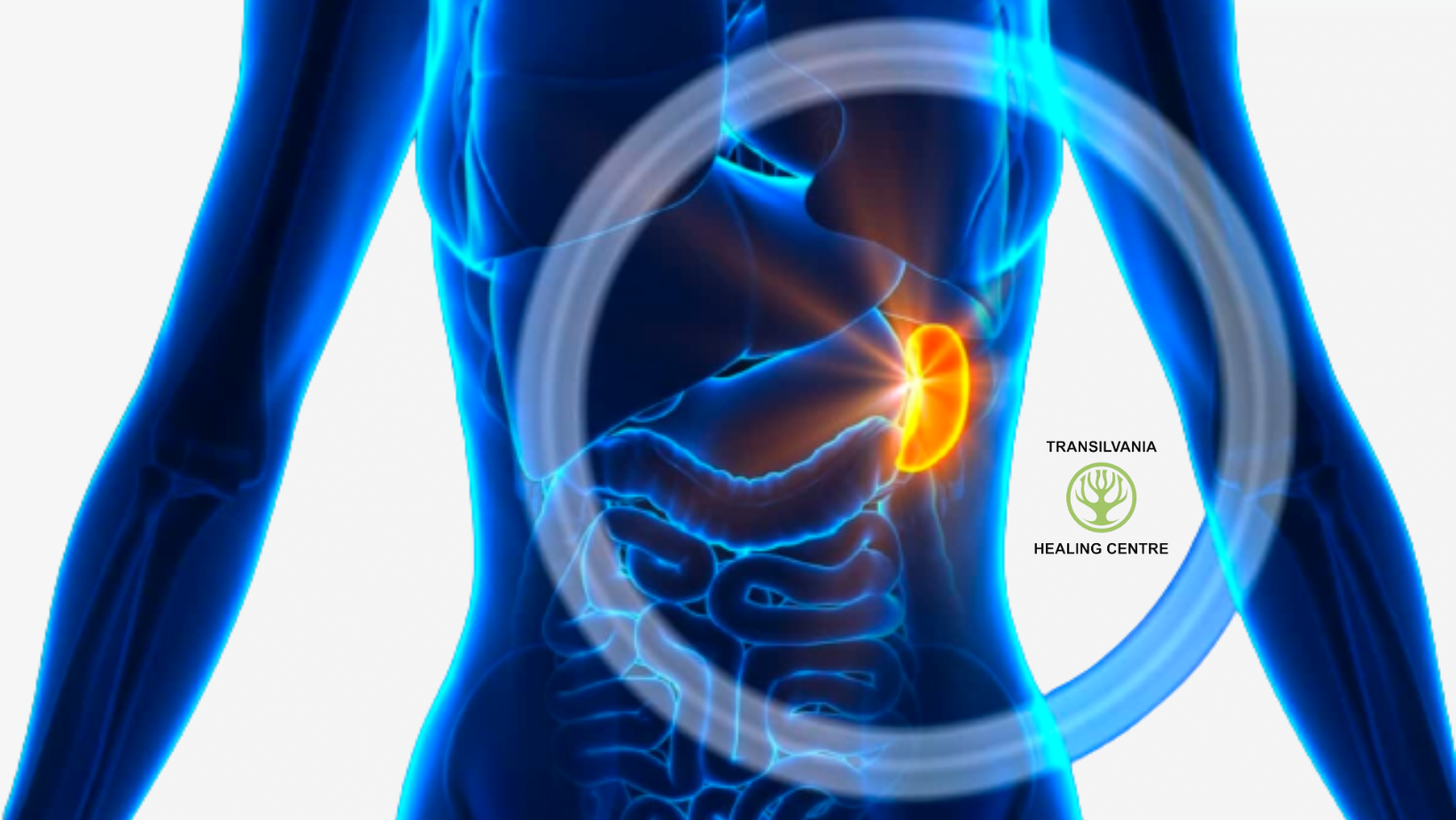 Tumorile nu trebuie să fie un capăt de drum 1 Tumorile Imagini inspiraționale despre lupta împotriva cancerului