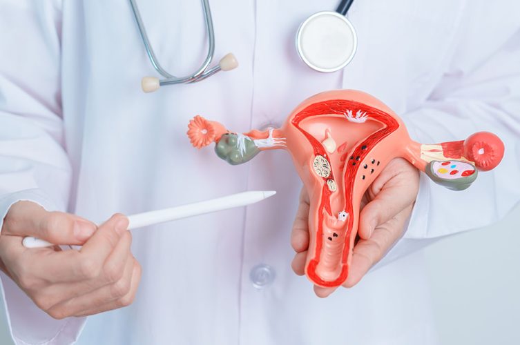 Endometrioză - Metode Eficiente de Gestionare și Tratament