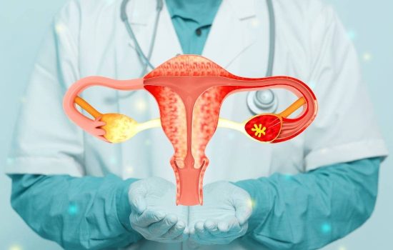 Endometrioză Simptome, Cauze și Soluții pentru Gestionare